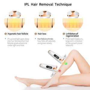 Best Laser Epilator Hair Removal Device At Home Machine